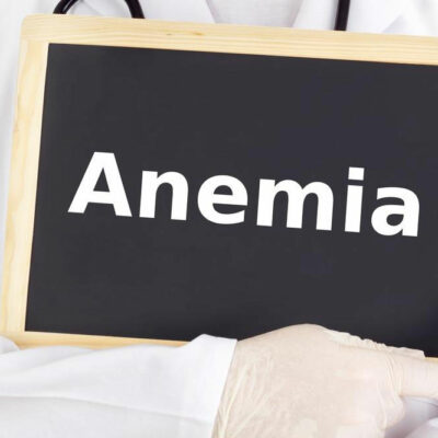 6 Symptoms and Factors of Anemia